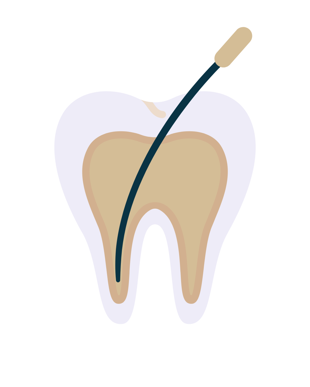 Oral Hygiene and Prevention